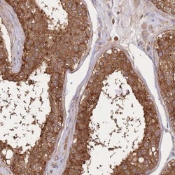 SLC4A9 Antibody, Novus Biologicals:Antibodies:Primary Antibodies