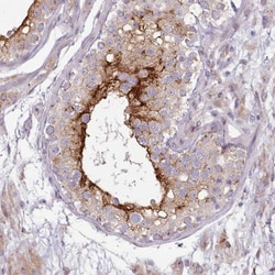 SLC52A3 Antibody, Novus Biologicals:Antibodies:Primary Antibodies