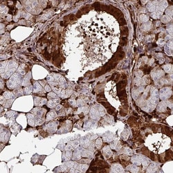SLC5A10 Antibody, Novus Biologicals 0.1mL; Unlabeled:Antibodies, Polyclonal