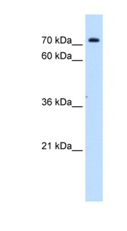 SLC5A11 Antibody, Novus Biologicals 20&mu;L; Unlabeled:Antibodies, Polyclonal