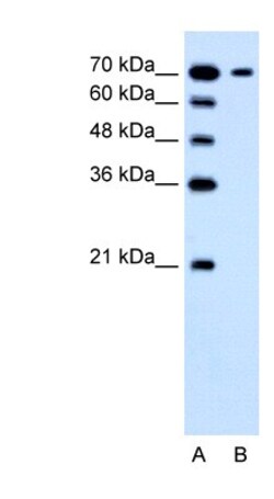 SGLT3/SLC5A4 Antibody, Novus Biologicals 0.1mg; Unlabeled:Antibodies, Polyclonal