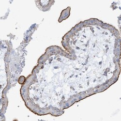 SLC6A12 Antibody, Novus Biologicals 0.1mL; Unlabeled:Antibodies, Polyclonal