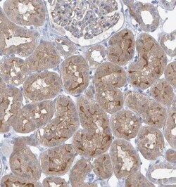 SLC6A12 Antibody, Novus Biologicals 0.1mL; Unlabeled:Antibodies, Polyclonal