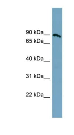 SLC6A14 Antibody, Novus Biologicals 0.05mg; Unlabeled:Antibodies, Polyclonal
