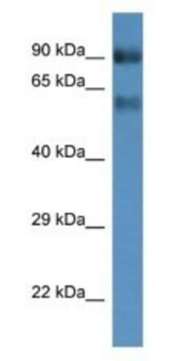 SLC6A15 Antibody, Novus Biologicals 100&mu;L; Unlabeled:Antibodies, Polyclonal