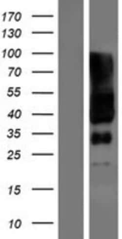 Novus Biologicals™ SLC6A17 Overexpression Lysate