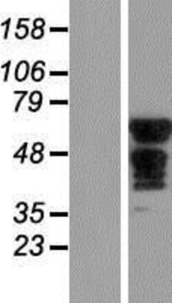 Novus Biologicals&trade;&nbsp;SLC6A18 Overexpression Lysate