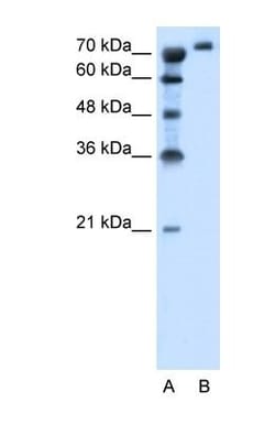 SLC6A18 Antibody, Novus Biologicals:Antibodies:Primary Antibodies