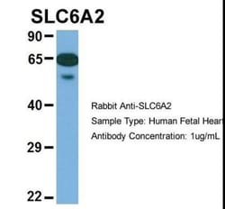 SLC6A2/NET/Noradrenaline transporter Antibody, Novus Biologicals 0.05mg;