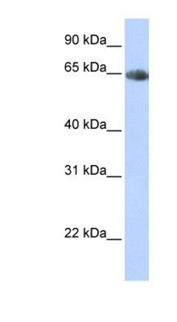 SLC6A2/NET/Noradrenaline transporter Antibody, Novus Biologicals 0.05mg;