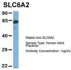 SLC6A2/NET/Noradrenaline transporter Antibody, Novus Biologicals 0.05mg;
