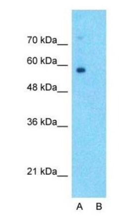 SLC6A2/NET/Noradrenaline transporter Antibody, Novus Biologicals 0.05mg;