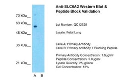SLC6A2/NET/Noradrenaline transporter Antibody, Novus Biologicals 0.05mg;