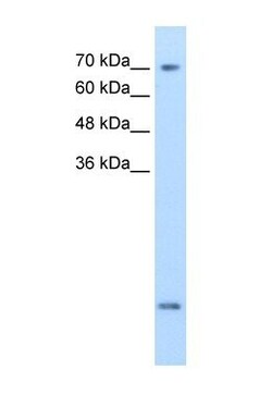 SLC6A8 Antibody, Novus Biologicals 0.1mg; Unlabeled:Antibodies, Polyclonal