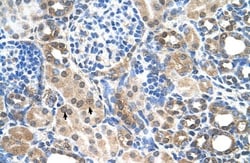 SLC7A14 Antibody, Novus Biologicals:Antibodies:Primary Antibodies