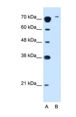 SLC7A14 Antibody, Novus Biologicals:Antibodies:Primary Antibodies