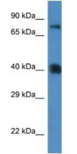 CAT3/SLC7A3 Antibody, Novus Biologicals 100&mu;L; Unlabeled:Antibodies,