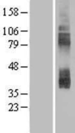 Novus Biologicals&trade;&nbsp;CAT3/SLC7A3 Overexpression Lysate