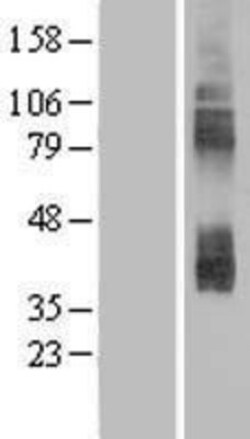 Novus Biologicals&trade;&nbsp;CAT3/SLC7A3 Overexpression Lysate