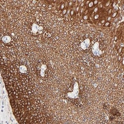 CAT3/SLC7A3 Antibody, Novus Biologicals 0.1mL; Unlabeled:Antibodies, Polyclonal