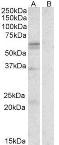 SLC7A5/LAT1 Antibody, Novus Biologicals 0.1mg; Unlabeled:Antibodies, Polyclonal