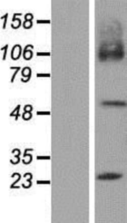 Novus Biologicals&trade;&nbsp;SLC7A7 Overexpression Lysate