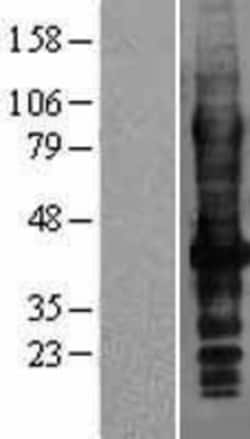 Novus Biologicals&trade;&nbsp;SLC7A8 Overexpression Lysate