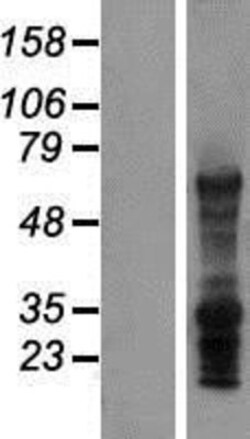 Novus Biologicals™ SLC7A8 Overexpression Lysate