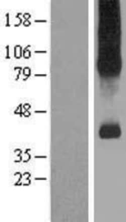 Novus Biologicals&trade;&nbsp;SLC7A9 Overexpression Lysate