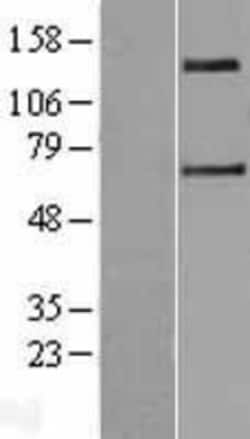 Novus Biologicals SLC9A2 Overexpression Lysate 0,1 mg | Buy Online | Novus Biologicals&trade; | Fisher Scientific