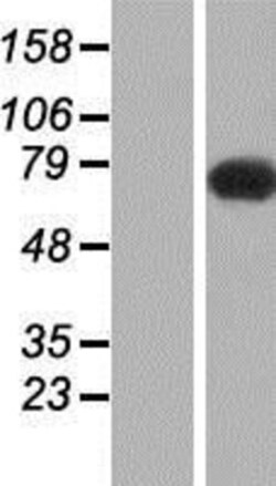 Novus Biologicals&trade;&nbsp;NHE6/SLC9A6 Overexpression Lysate
