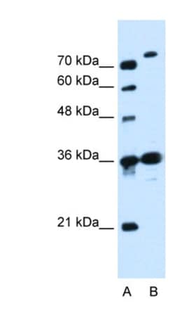 SLC9A7 Antibody, Novus Biologicals 0.05mg; Unlabeled:Antibodies, Polyclonal