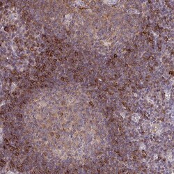 SLC9A9 Antibody, Novus Biologicals 25 &mu;L, Unlabeled:Antibodies, Polyclonal
