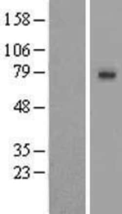 Novus Biologicals SLCO1A2 Overexpression Lysate 0.1 mg | Buy Online | Novus Biologicals&trade; | Fisher Scientific