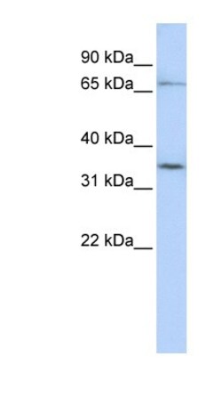 SLCO1C1 Antibody, Novus Biologicals 100&mu;L; Unlabeled:Antibodies, Polyclonal