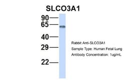 SLCO3A1 Antibody, Novus Biologicals 0.05mg; Unlabeled:Antibodies, Polyclonal