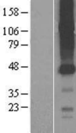 Novus Biologicals&trade;&nbsp;SLCO4C1 Overexpression Lysate