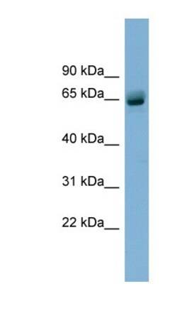 SLFN12 Antibody, Novus Biologicals:Antibodies:Primary Antibodies