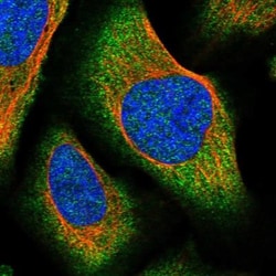 SLFN14 Antibody, Novus Biologicals 0.1mL; Unlabeled:Antibodies, Polyclonal