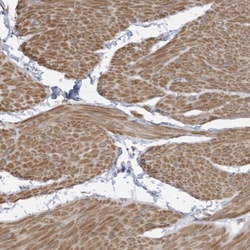 SLFN14 Antibody, Novus Biologicals:Antibodies:Primary Antibodies