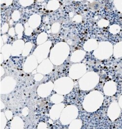 SLFN5 Antibody, Novus Biologicals 25 &mu;L; Unlabeled:Antibodies, Polyclonal