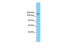 Slit3 Antibody, Novus Biologicals 0.05mg; Unlabeled:Antibodies, Polyclonal