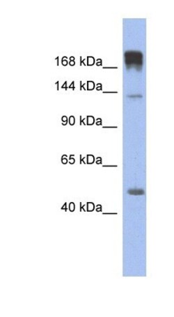 Slit3 Antibody, Novus Biologicals 0.05mg; Unlabeled:Antibodies, Polyclonal