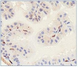 SLITRK1 Antibody - BSA Free, Novus Biologicals:Antibodies:Primary Antibodies