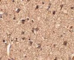 SLITRK1 Antibody - BSA Free, Novus Biologicals 0.1mg; Unlabeled:Antibodies,