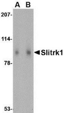 SLITRK1 Antibody - BSA Free, Novus Biologicals 0.1mg; Unlabeled:Antibodies,