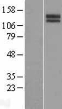 Novus Biologicals&trade;&nbsp;SLITRK3 Overexpression Lysate