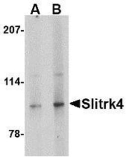 SLITRK4 Antibody - BSA Free, Novus Biologicals:Antibodies:Primary Antibodies