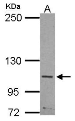 SLITRK5 Antibody, Novus Biologicals 0.1mL; Unlabeled:Antibodies, Polyclonal