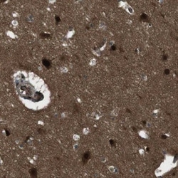 SLITRK5 Antibody, Novus Biologicals:Antibodies:Primary Antibodies